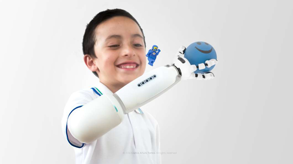 乐高最酷人工义肢机器人造福残疾儿1