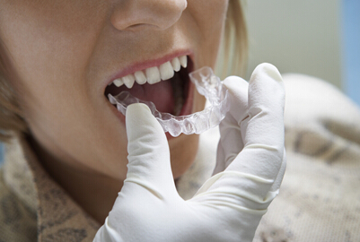 牙齿矫正迎来3D打印技术2