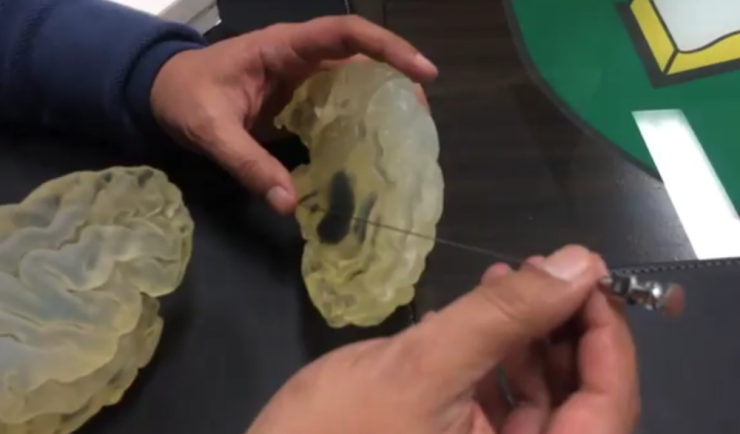 3D打印的脑子和正常的脑子哪个脑洞大？2