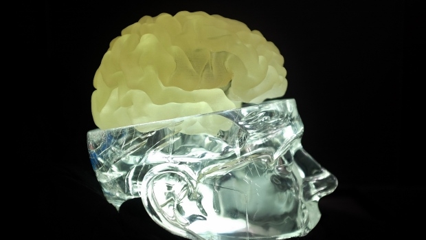 3D打印的脑子和正常的脑子哪个脑洞大？3