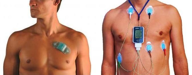 发明于移动医疗时代的心电监测，会比 Holter 更好吗？2