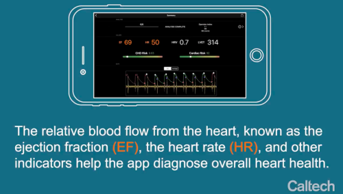 这款APP可取代超声测量法，两分钟即可诊断心脏健康
