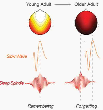 为什么老年人很健忘？科学家团队利用脑电波揭示了原因