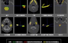 腾讯医疗AI实验室公布最新研究成果，用深度学习分割头颈组织区域助力靶向治疗